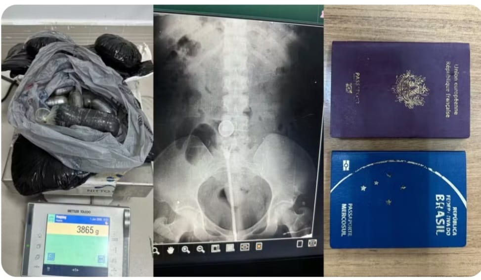 Mulher é flagrada com drogas nas partes íntimas, no aeroporto internacional de Belém
