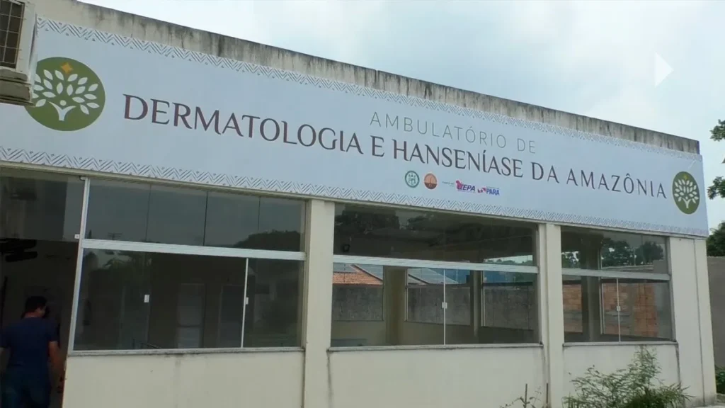 UEPA inaugura ambulatório de hanseníase em Marabá