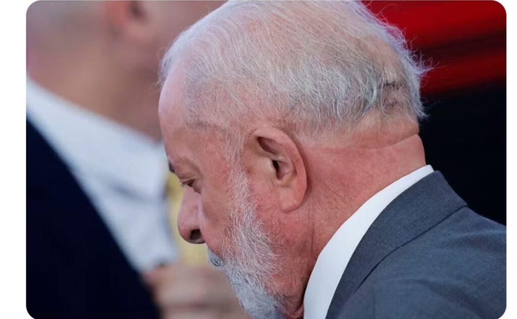 Lula passa por novo procedimento para evitar sangramento na cabeça