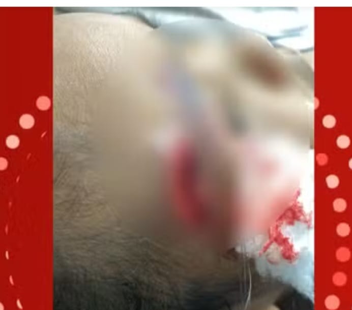 No MT, Mãe é presa por maus-tratos após agredir filha de 3 anos com cabo de vassoura