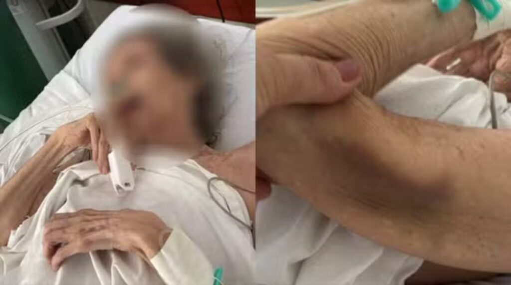 Morre mãe abandonada por filho advogado em unidade de saúde em estado gravíssimo, desnutria e com lesões, diz polícia