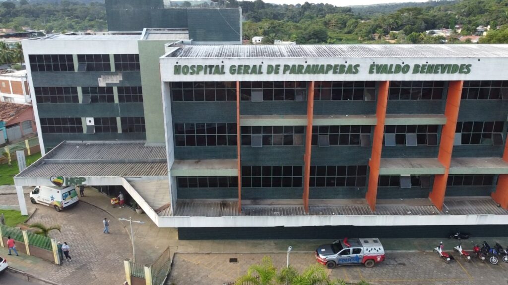 Homem sobrevive a tiro na testa em Parauapebas