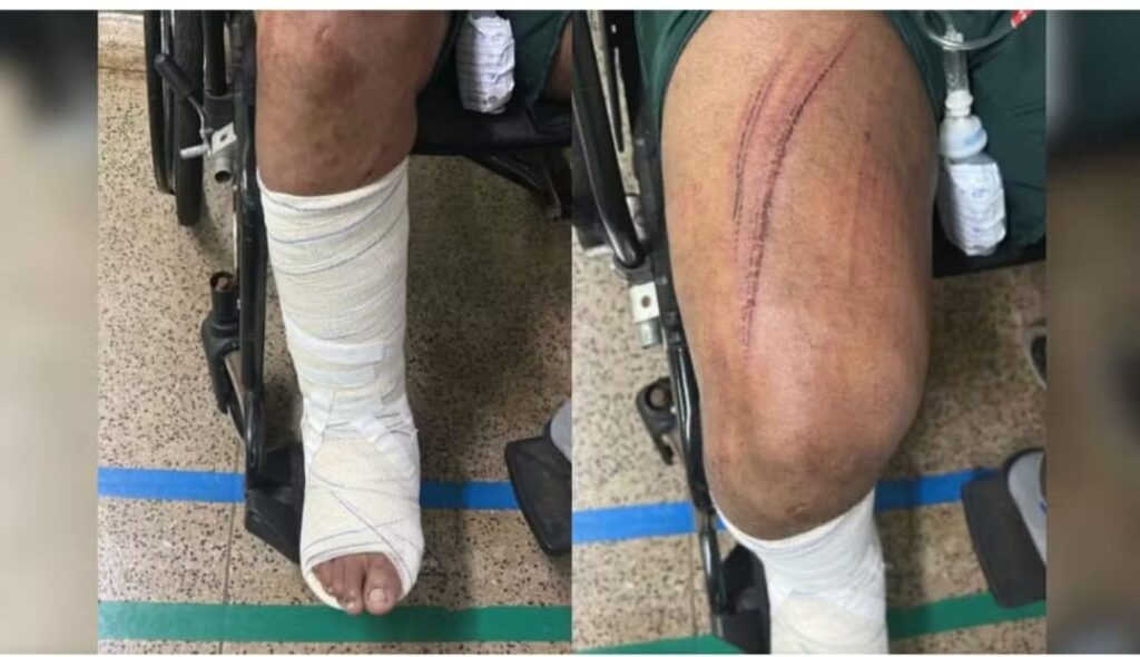 Em GO, Garoto de programa pula do 2º andar para fugir de cliente após briga por causa do pagamento, diz polícia