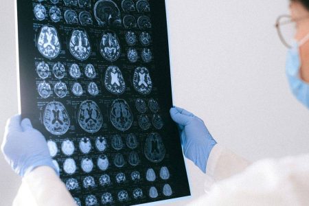 Pesquisas brasileiras avançam no diagnóstico de Alzheimer