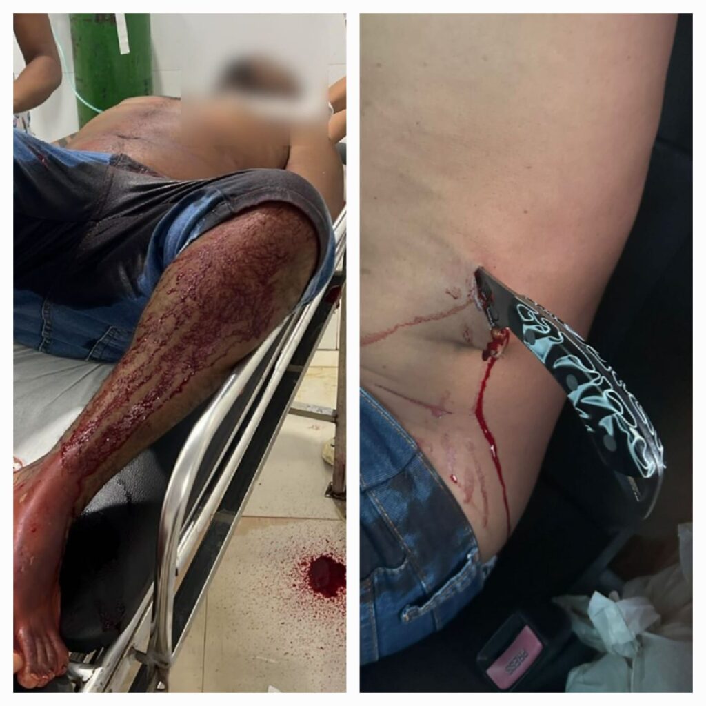 Duas tentativas de homicídios foram registradas em Ourilândia