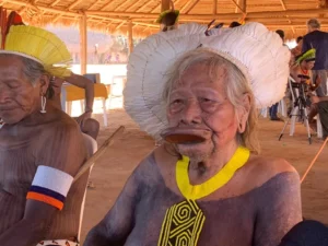 Cacique Raoni tem dreno de tórax retirado e segue estável na UT